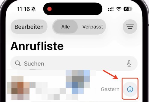 Tippen Sie auf das i-Symbol